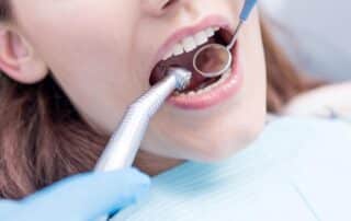 dentist amalgam removal mouth