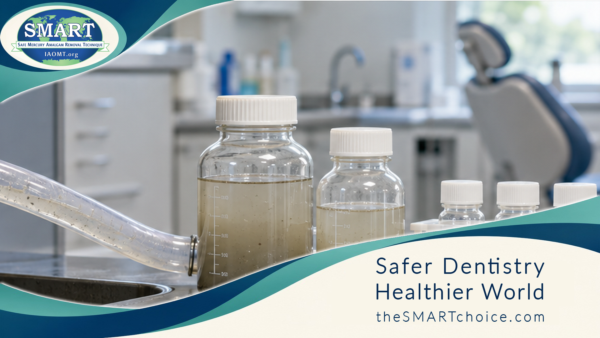 Clinic wastewater / mercury-burden lab still life in the SMART frame — no dentist, no removal.